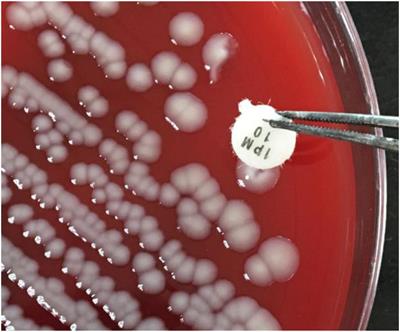 The Simplified Carbapenem Inactivation Method (sCIM) for Simple and Accurate Detection of Carbapenemase-Producing Gram-Negative Bacilli